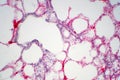 Human lung tissue under microscope view