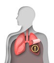 Human lung vector respiratory disease world day