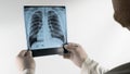 Human lung x-ray analysis  doctor examines lung disease. Pneumonia. Lung x-ray isolated on white background. Royalty Free Stock Photo