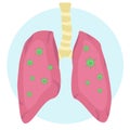 Human lungs affected by viral microorganisms