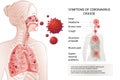 Human MERS-Cov symptoms risk factors. Virus outbreak spread pandemic. Royalty Free Stock Photo