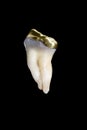 Human molar tooth Royalty Free Stock Photo