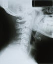 Human Neck Xray Royalty Free Stock Photo