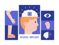 Neural implants flat vector illustration medical concept Royalty Free Stock Photo