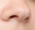 Human nose