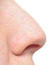 Human nose