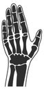Human palm xray. Hand bones anatomy illustration