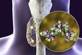 Human parathyroid hormone