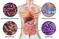 Human pathogenic microbes, respiratory and enteric pathogens Royalty Free Stock Photo