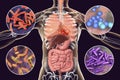 Human pathogenic microbes, respiratory and enteric pathogens