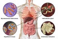 Human pathogenic microbes, respiratory and enteric pathogens