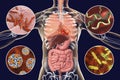 Human pathogenic microbes, respiratory, enteric and liver pathogens