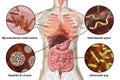 Human pathogenic microbes, respiratory, enteric and liver pathogens