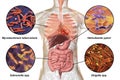 Human pathogenic microbes, respiratory and enteric pathogens