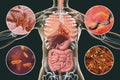 Human pathogenic microbes, respiratory and enteric pathogens