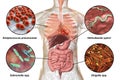 Human pathogenic microbes, respiratory and enteric pathogens