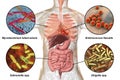 Human pathogenic microbes, respiratory and enteric pathogens