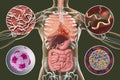 Human pathogenic microbes, respiratory and enteric pathogens