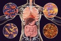 Human pathogenic microbes, respiratory and enteric pathogens