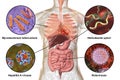 Human pathogenic microbes, respiratory and enteric pathogens