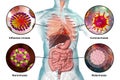 Human pathogenic viruses causing respiratory and enteric infections