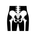 Human pelvis anatomy.