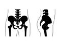 Human pelvis anatomy.