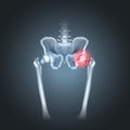 Human pelvis hip pain Royalty Free Stock Photo