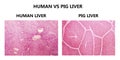 Human and pig liver Royalty Free Stock Photo