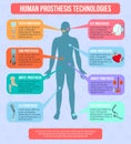 Human Prothesis Technologies Infographics Royalty Free Stock Photo