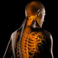 Human radiography scan Royalty Free Stock Photo