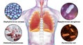 Human respiratory pathogens