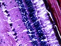 Human retina under the microscope Royalty Free Stock Photo