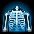 Human rib cage. x-ray blue realistic torso Royalty Free Stock Photo