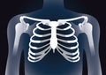 Human rib cage in X-ray image concept. Royalty Free Stock Photo