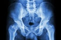 Human's pelvis and hip joints Royalty Free Stock Photo