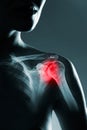 Human shoulder joint in x-ray