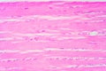 Human skeletal muscle under microscope view for education pathology