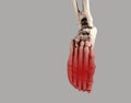 Human skeleton foot with red point at forefoot. Injury, excessive physical activity, ill-fitting shoes consequences Royalty Free Stock Photo