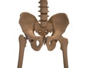 Human skeleton with a metal hip prosthesis concept arthroplasty