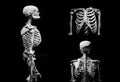 Human skeleton partner anatomical death abstract isloated partner Royalty Free Stock Photo