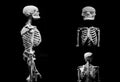 Human skeleton partner anatomical death abstract isloated partner Royalty Free Stock Photo