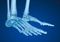 Human skeleton: skeletal foot. Royalty Free Stock Photo