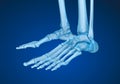 Human skeleton: skeletal foot. Royalty Free Stock Photo