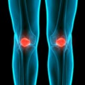 Human Skeleton System Patella Bone Joints Anatomy