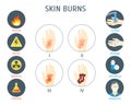 Human Skin Burns Infographic Card Poster. Vector Royalty Free Stock Photo