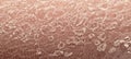 Human skin epidermis texture with flaking and cracked particles Royalty Free Stock Photo