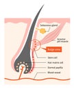 Human skin and hair anatomy illustration. hair bulge stem cells generate hair grow. Medical, beauty, and educational use