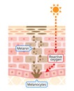 Human skin layer of melanin and facial dark spots. Infographic skin layer illustration. Beauty and skin care concept