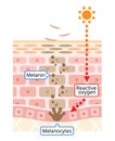 Human skin layer of melanin and facial dark spots. Infographic skin layer illustration. Beauty and skin care concept